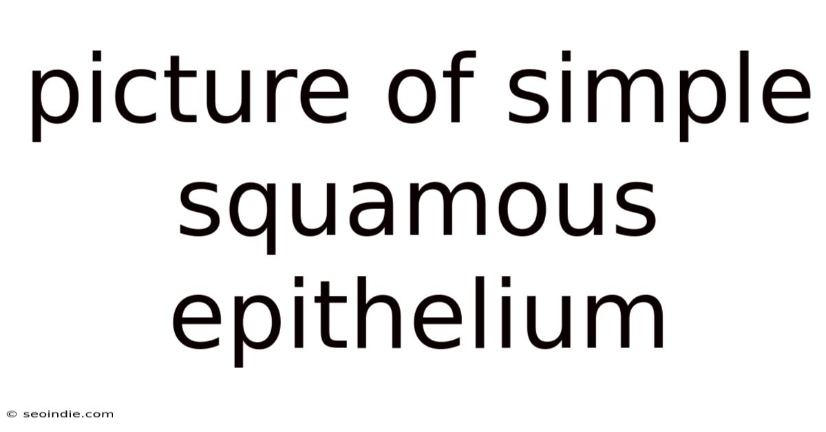 Picture Of Simple Squamous Epithelium