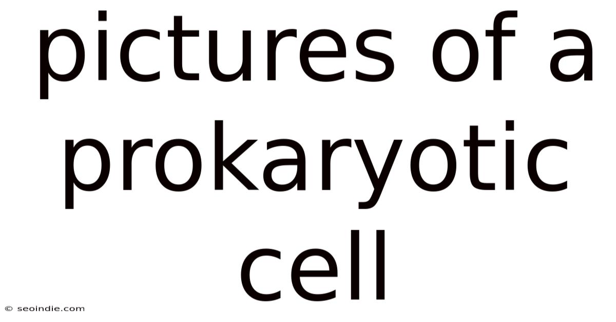 Pictures Of A Prokaryotic Cell